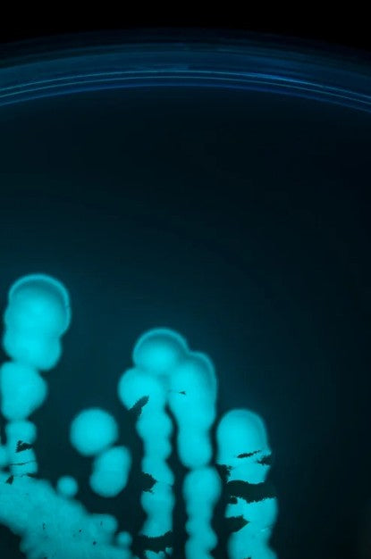 Portrait of Escherichia coli, 01